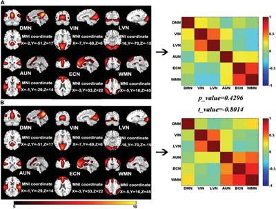 The integrative functional connectivity analysis between seafarer’s brain networks using functional magnetic resonance imaging data of different states